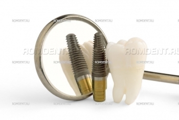 ROMDENT | Dental prosthesis placement on implants - Turnkey dental implantation