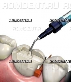 ROMDENT | Пломбы