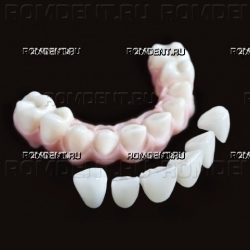 ROMDENT | Конструкции на имплантах