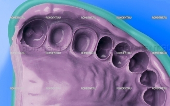 ROMDENT | Слепочные массы