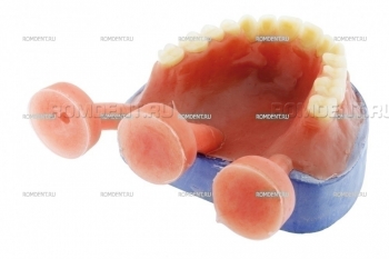 ROMDENT | Термоинджекционные протезы