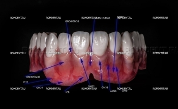 ROMDENT | Технологии