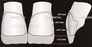 ROMDENT | Technology