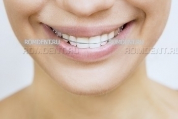 ROMDENT | Aesthetic dentistry and orthodontics