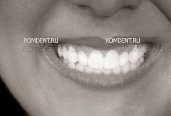 ROMDENT | Эстетическая стоматология и ортодонтия