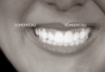 ROMDENT | Aesthetic dentistry and orthodontics