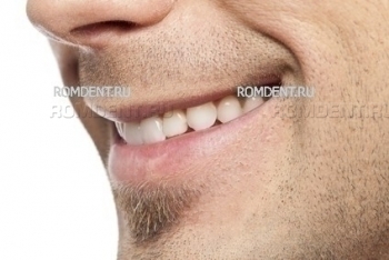 ROMDENT | Aesthetic dentistry and orthodontics