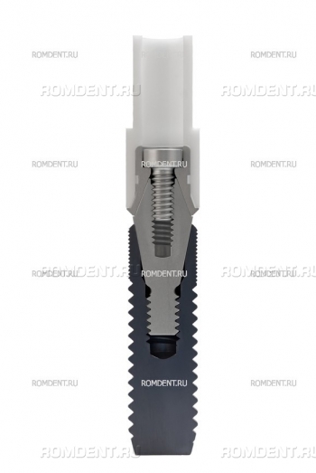 ROMDENT | Dental prosthesis placement on implants - Turnkey dental implantation