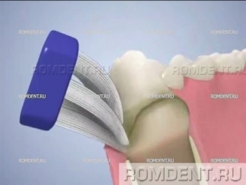 ROMDENT | Gum Treatment and Prevention