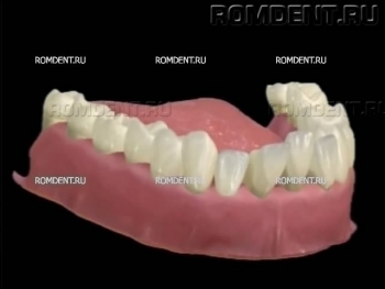 ROMDENT | Лечение десен и профилактика