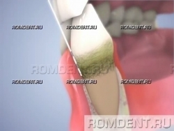 ROMDENT | Участие стоматолога