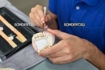 ROMDENT | Лечение и протезирование зубов в Москве