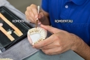 ROMDENT | Dentistry and prosthetics in Moscow