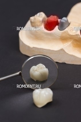 ROMDENT | Dentistry and prosthetics in Moscow