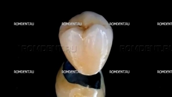 ROMDENT | Зубная металлокерамика