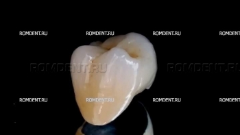 ROMDENT | Зубная металлокерамика
