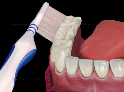 ROMDENT | Правильный выбор зубной пасты и щетки
