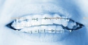 ROMDENT | Aesthetic dentistry and orthodontics