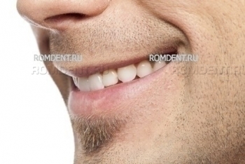 ROMDENT | Эстетическая стоматология и ортодонтия