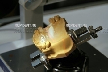 ROMDENT | Dentistry and prosthetics in Moscow